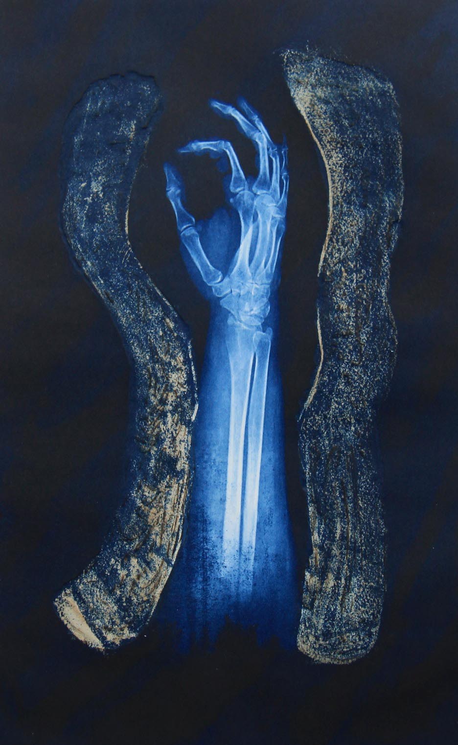 "Broken Arms" etat II, photogravure and spit bite etching print, 15" x 21”, colour edition of 30